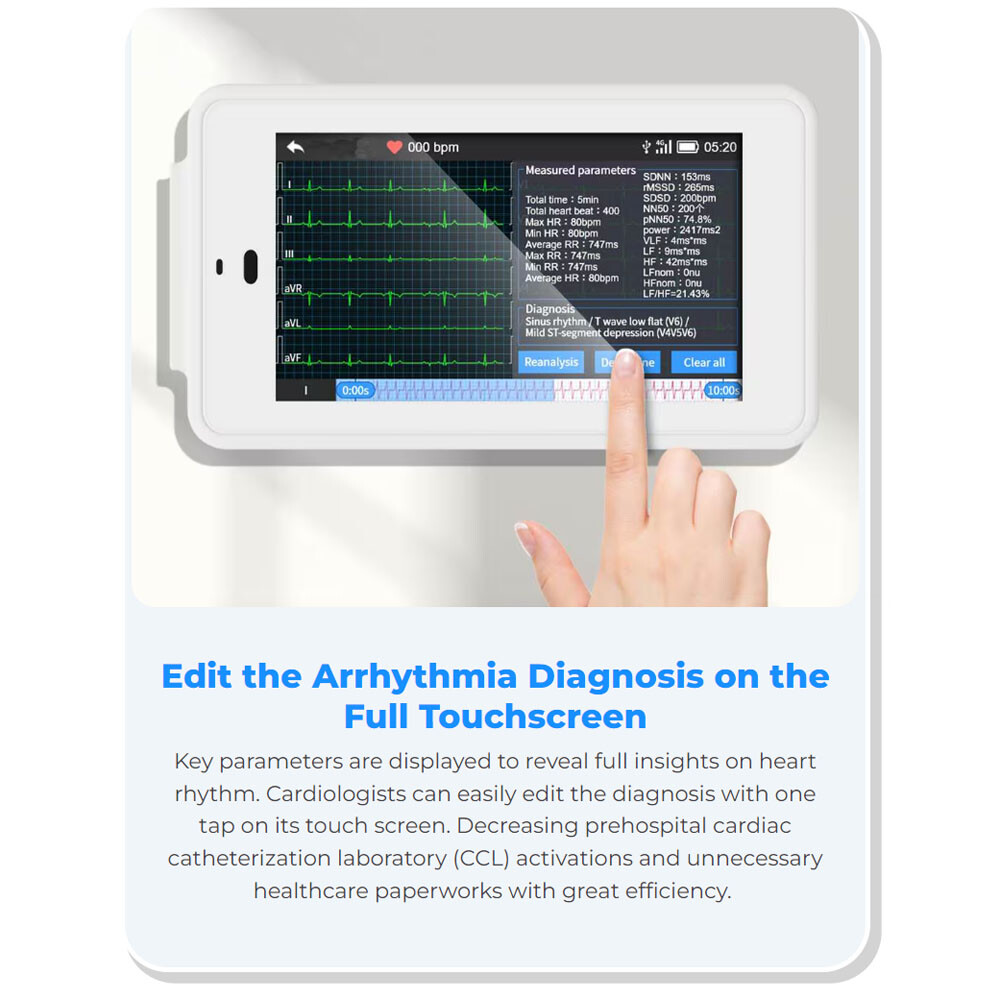 12-Lead ECG Machine Diagnostic Automatic Interpretation data transfer via email