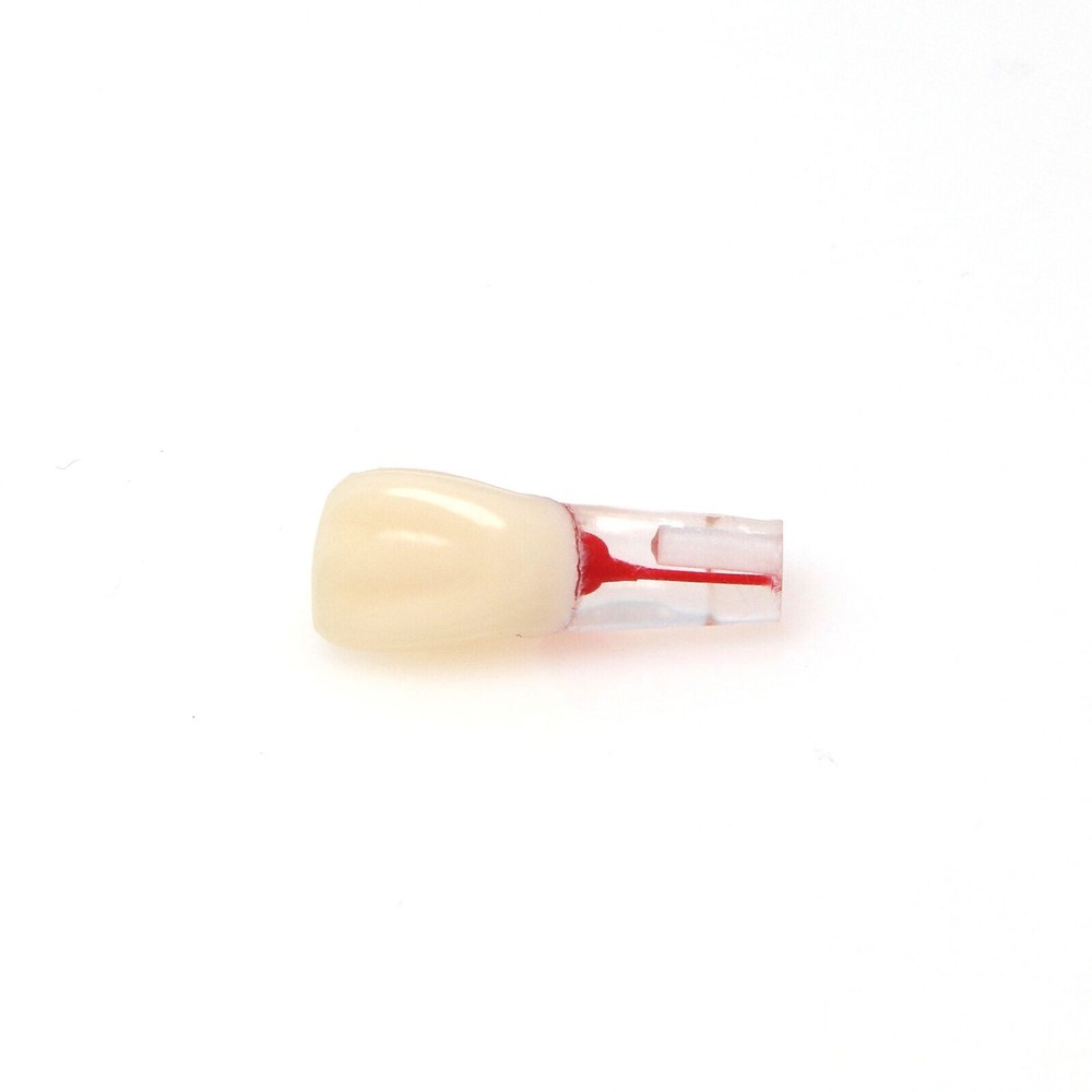 10Pcs/Set Dental Endo Root Canal Teeth Model Study RCT Practice Typodont Model