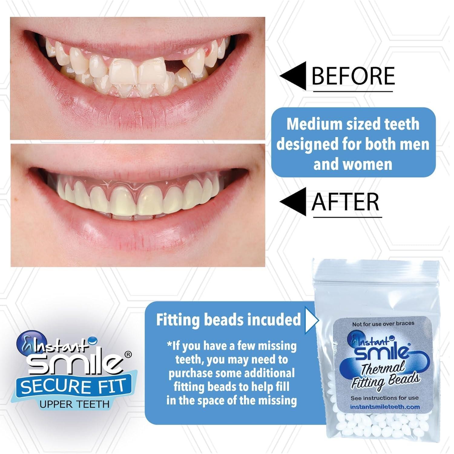 Just Released - Instant Smile Secure Fit Upper Teeth Veneer - Natural Shade