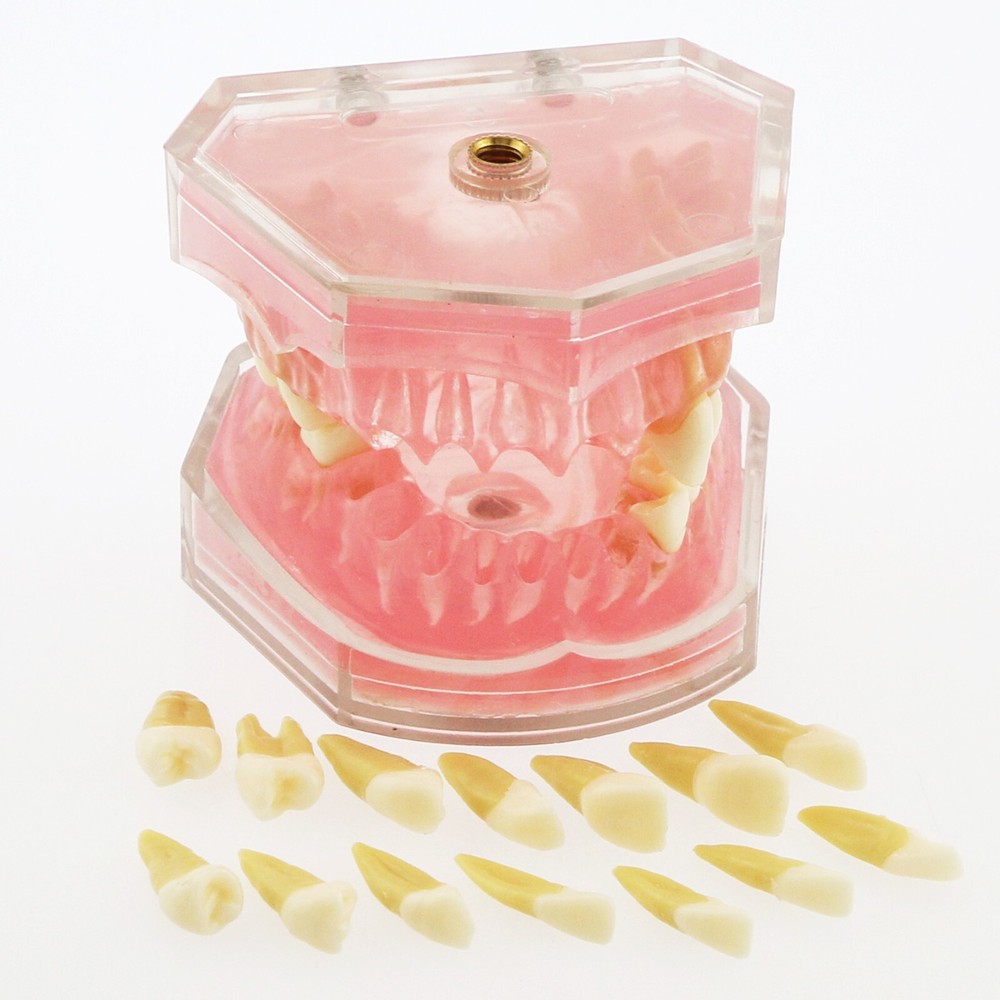 Dental Ortho Standard Teeth Study Demonstration Teaching Model Removable Teeth