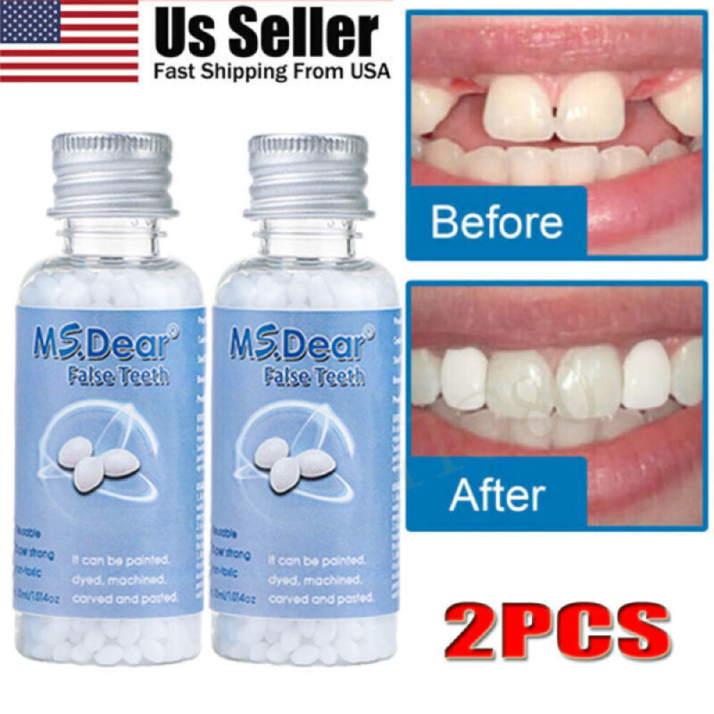 2X False Teeth Solid Glue Temporary Tooth Repair Kit Teeth Gaps Denture Adhesive