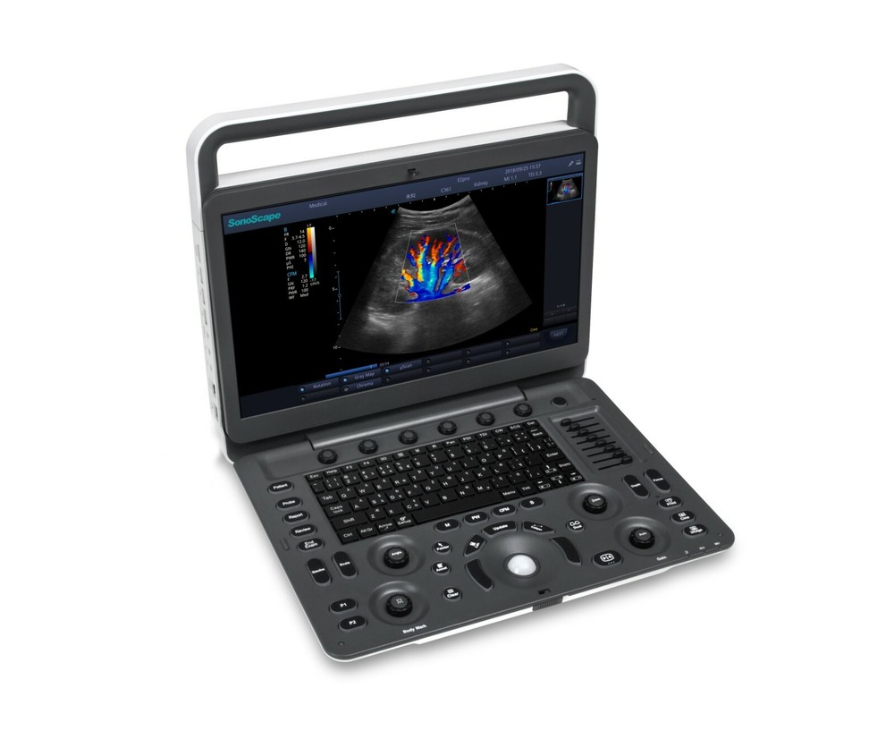 SonoScape E2 ultrasound & One linear array probe L741 Color doppler Vascular