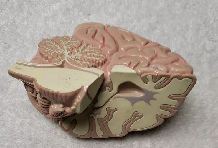 GPI Brain/ Partial Skull Model