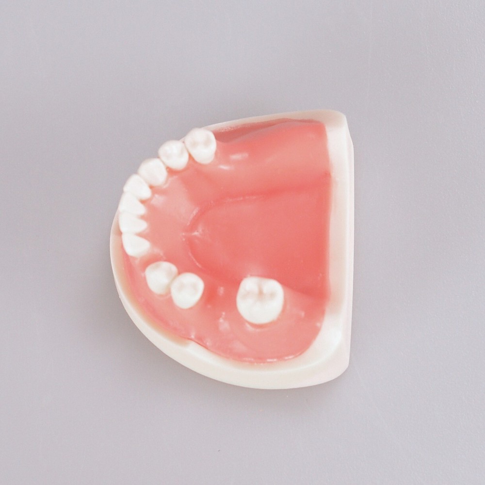 Dental Teeth Missing Implanting Typodont Training Dentistry Model Display