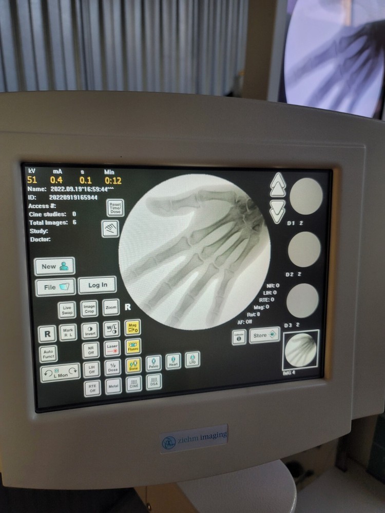 c-arm pain management