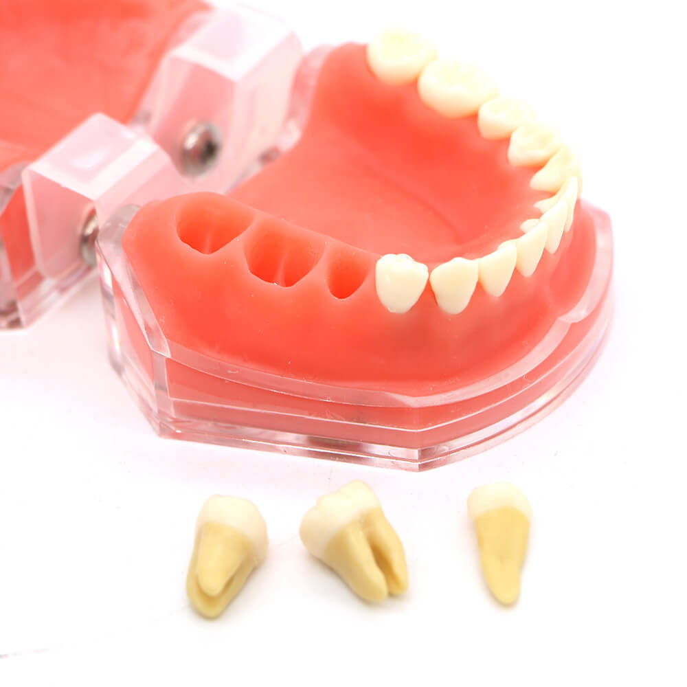 Orthodontic Study Model 4004 with 28 Removable Teeth for Dental Bracket Training