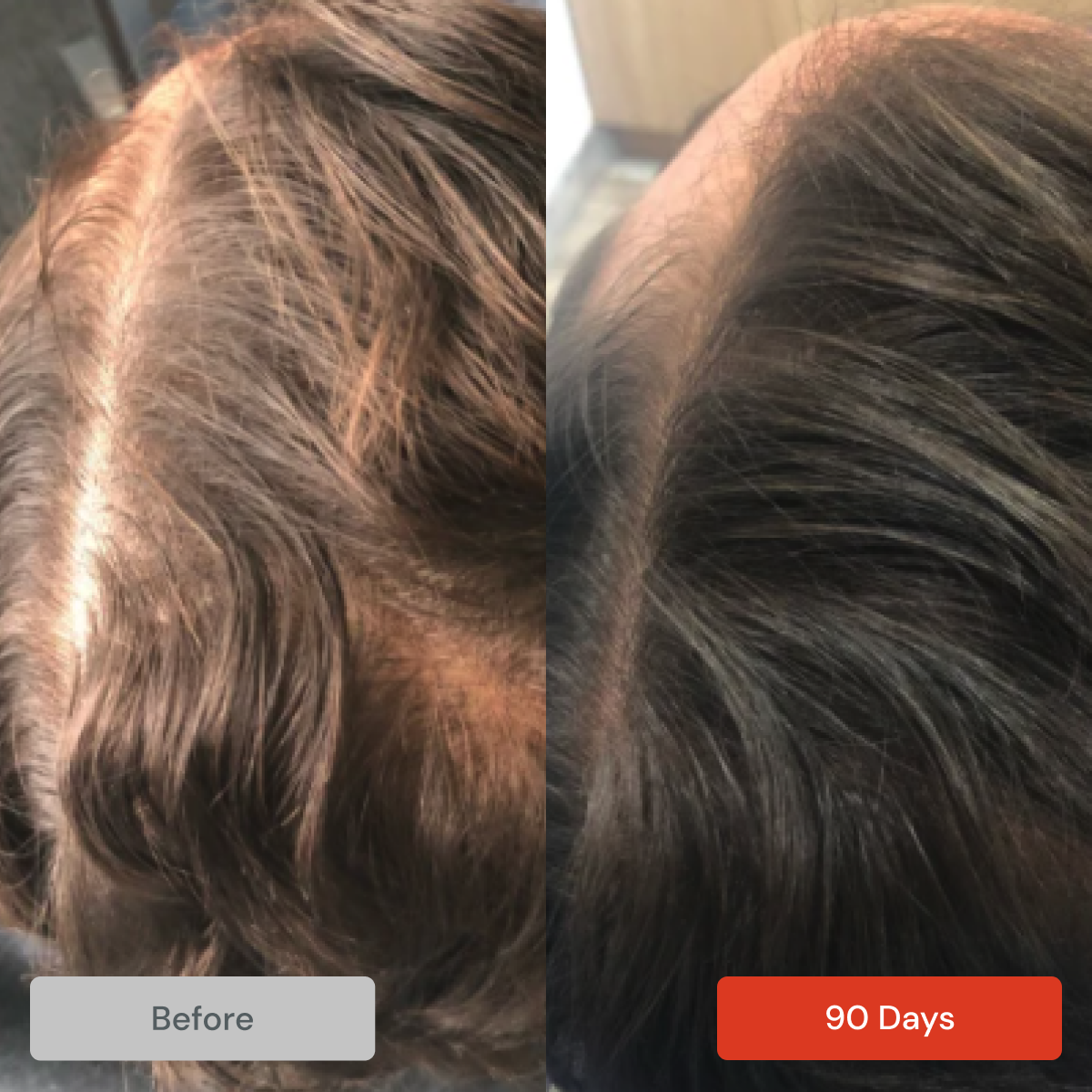 REVITA Shampoo (925ml) by DS Laboratories for Thinning Hair