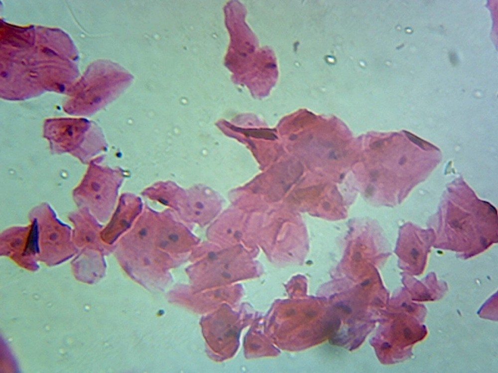 Cellular Nucleus, from Animal Cells; Section