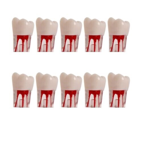Dental Endo Root Canal Practice Teeth Model Pulp Study Practice Pulp Cavity #16