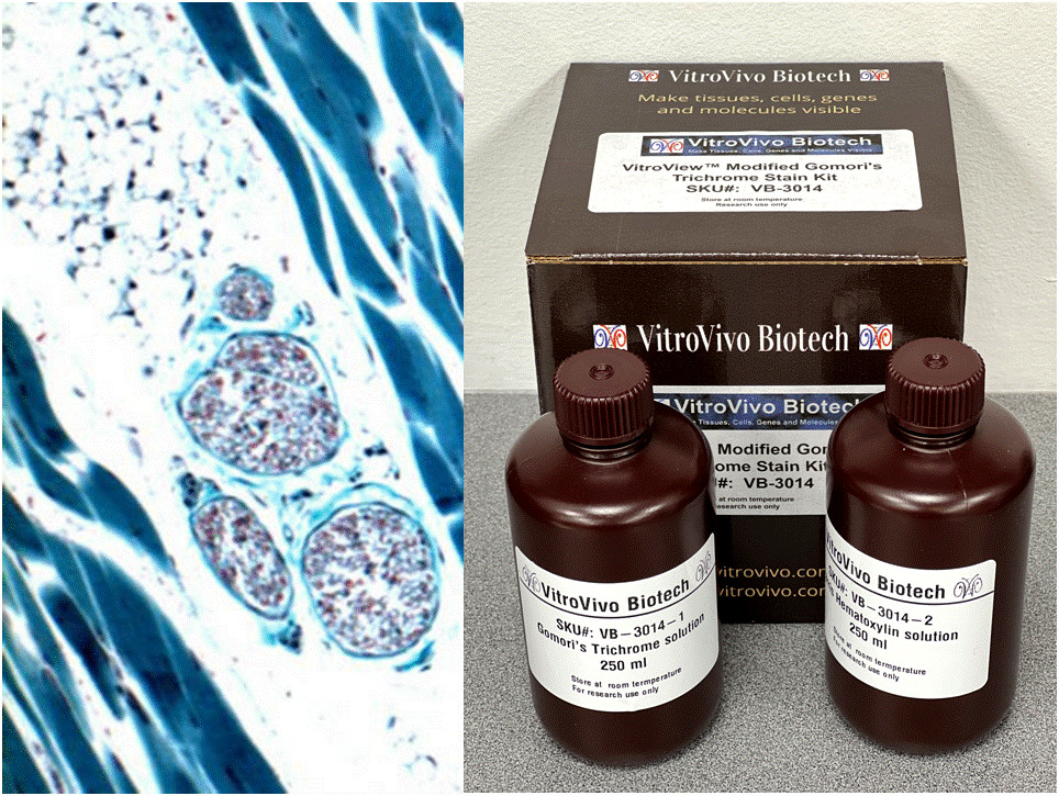 VitroView™ Modified Gomori’s Trichrome Stain Kit (Cat#VB-3014)