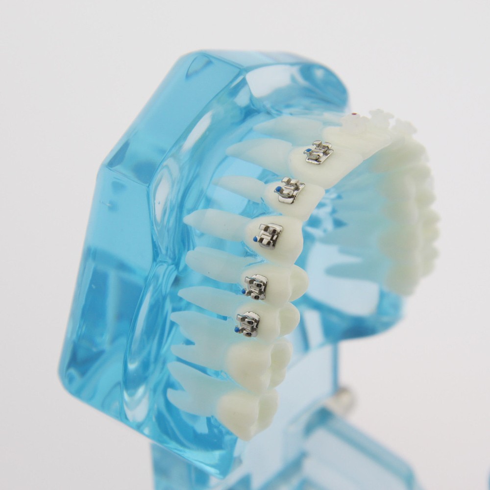 Dental Teach Study Typodont Teeth Model Half Metal Bracket Half Ceramic Bracket
