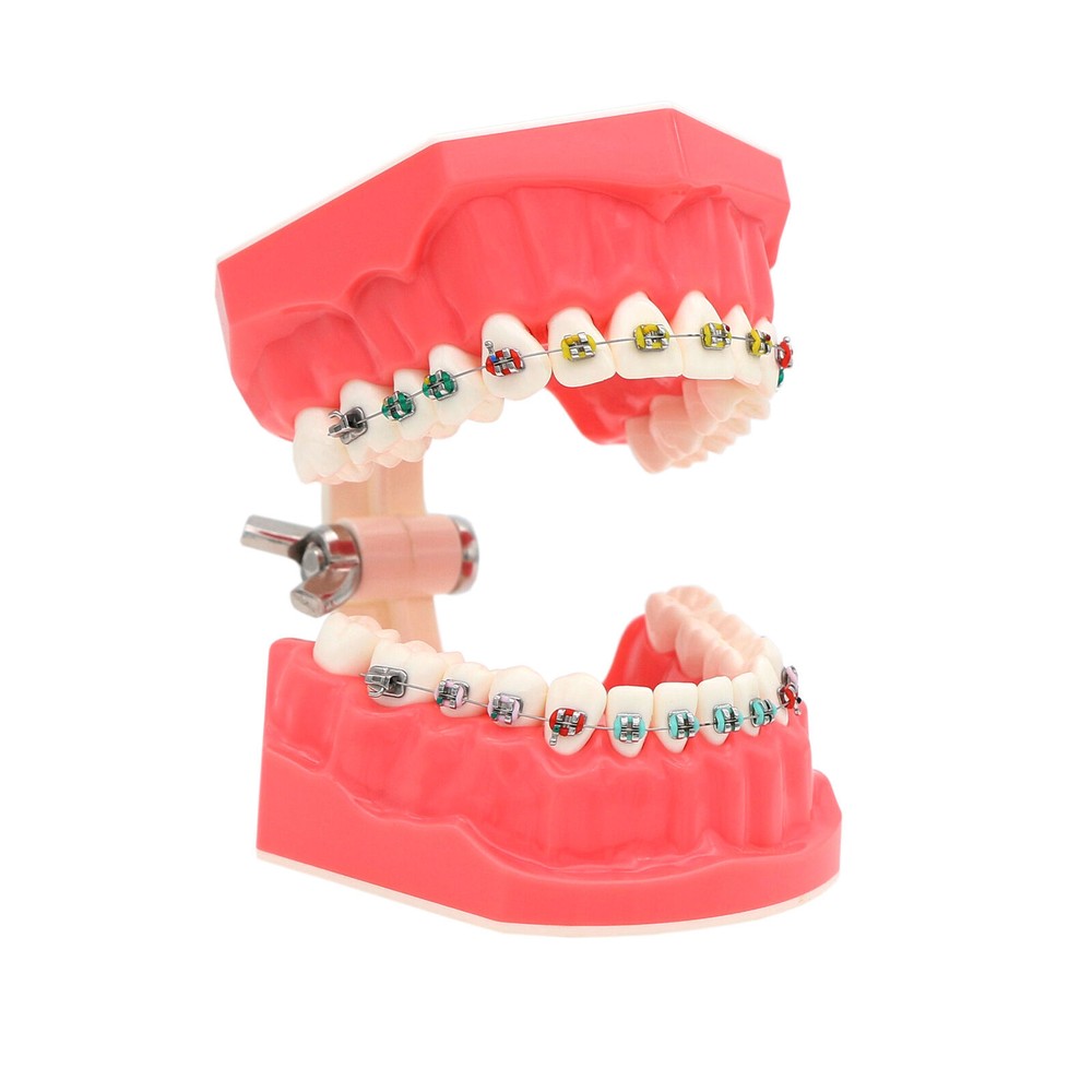1:1 Dental Teach Study Typodont Teeth Model With Metal Ceramic Brackets Tubes