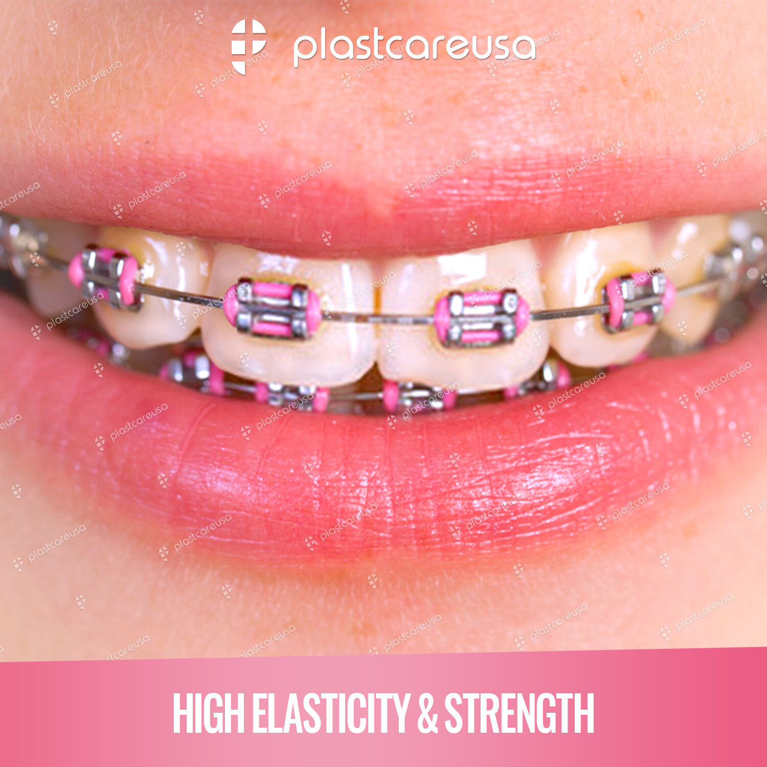 2080 Dental Ligature Rubber Ties Bands Braces Orthodontic Elastic Colored 2 Bags