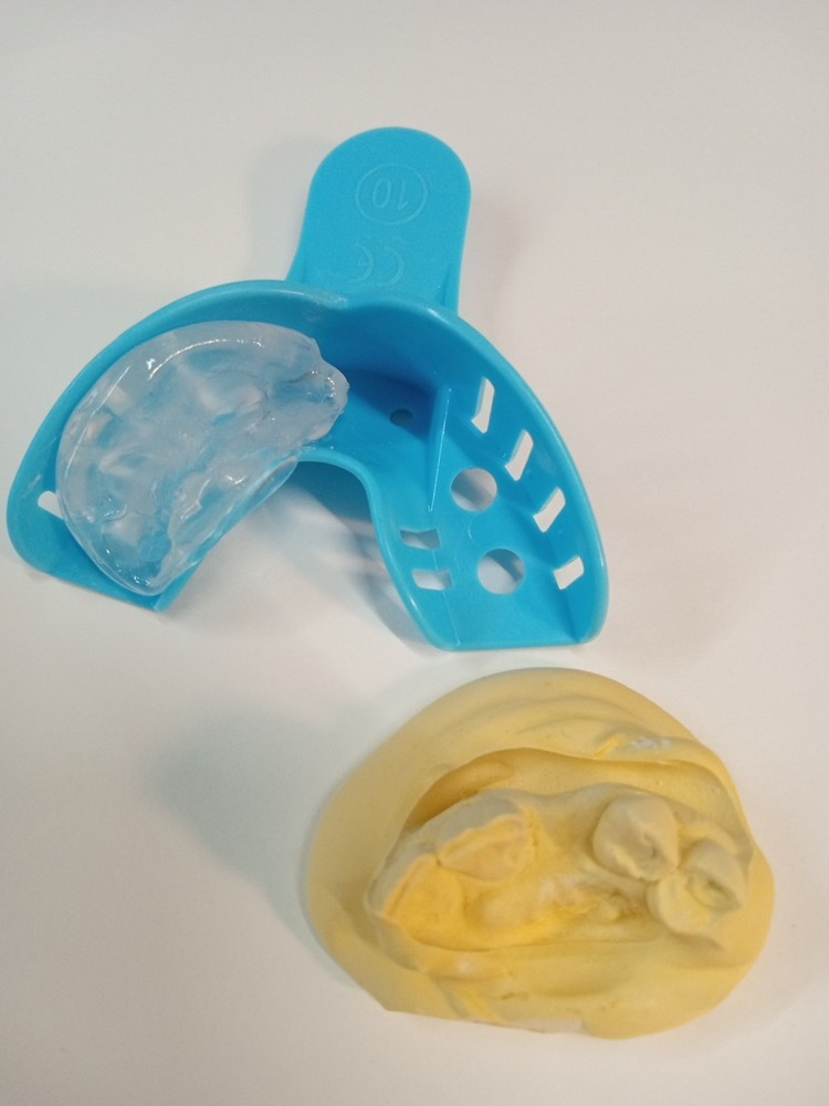 DIY Nesbit Tooth Partial, Give Us Your #'s *See Full DESCRIPTION before buying.*