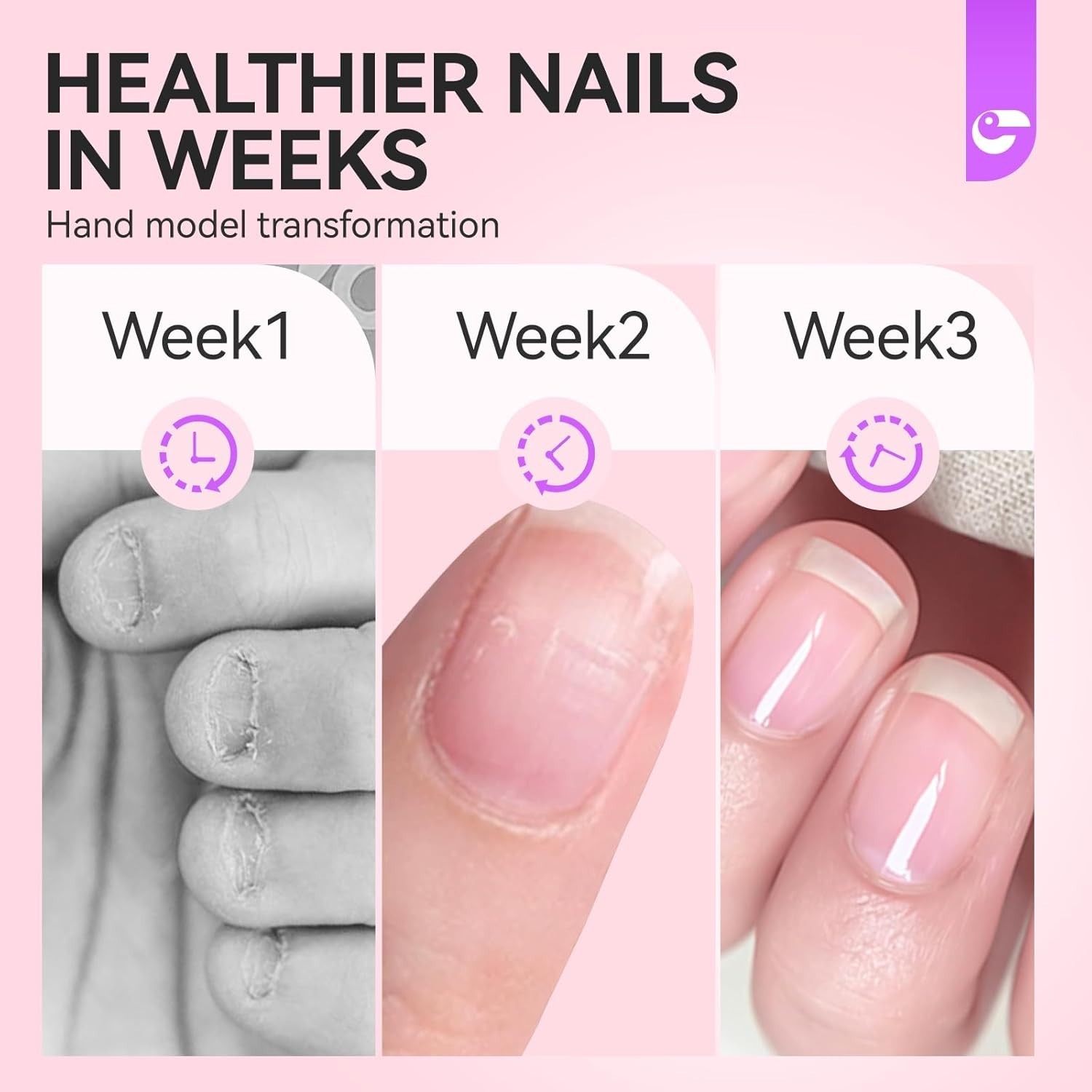Nail Biting Prevention for Adults and Kids - Gelike EC Bitter Taste Stop Nails B