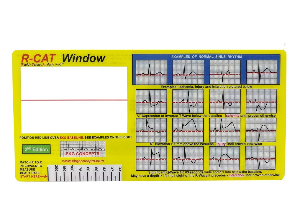 EKG Window 2nd Edition