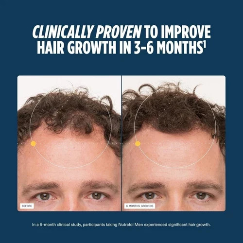 Men Hair Growth Nutraceuticals Dietary Supplement 120 Capsules EXPIR 2027