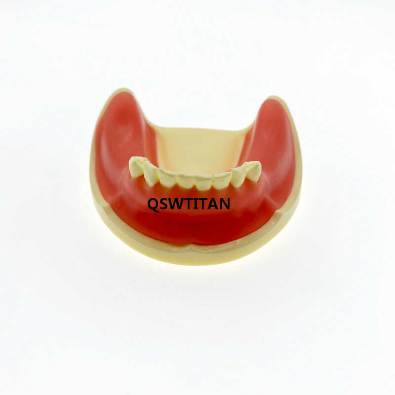 Teeth Model Implant Practice For incision drilling Practices Dental Study Model