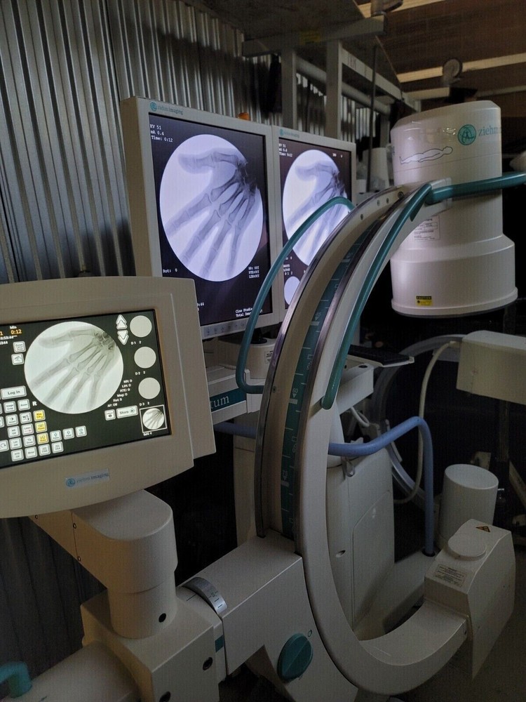 c-arm pain management