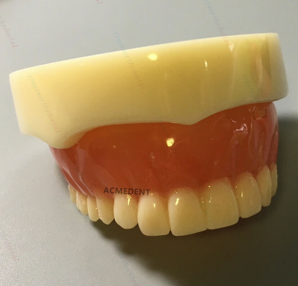 Dental Full Denture Model Overdenture Magnetic Attachment Mandibular Upper Study