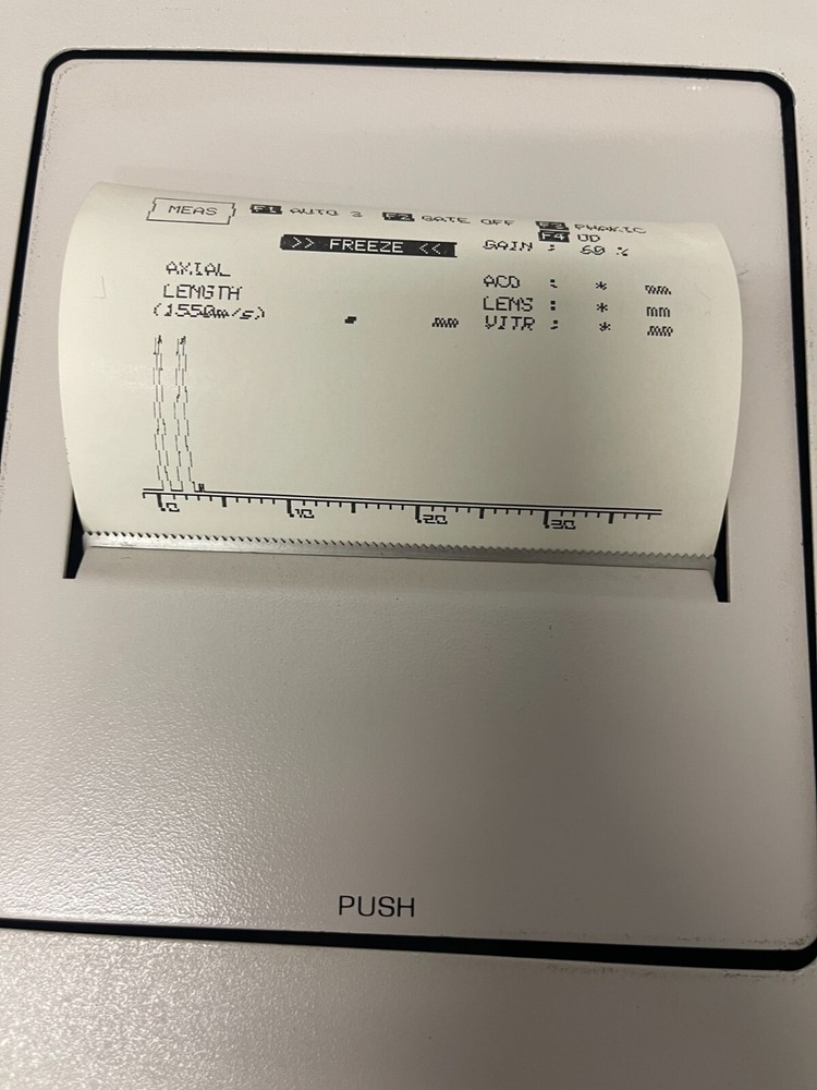 Nidek EchoScan 2000-Good Condition!