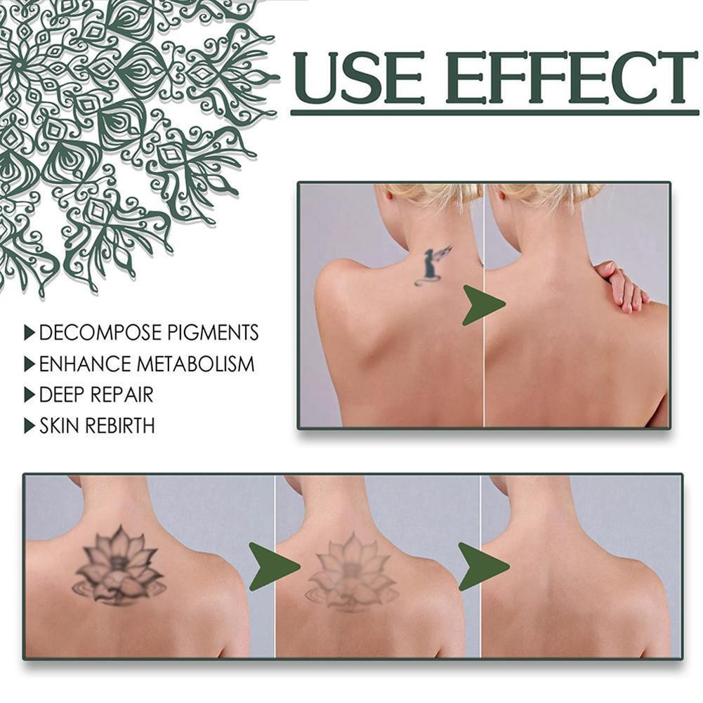 Quick Tattoo Removal Cream Natural Safe Pigment Permanent RemoverSpray J6R1