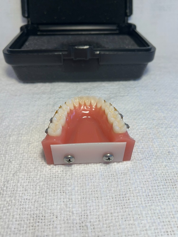 Orthodontic Study Model Dental Typodont - Gold & Silver Braces - Teaching Tool