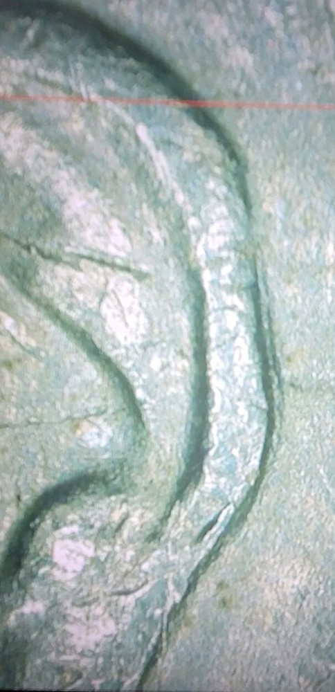 1972-D Eisenhower Dollar Double Strike Error