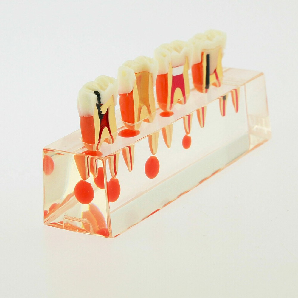 1 Pc Dental Study Typodont Teeth Model #4018 4 Stage Endodontic Treatment Model