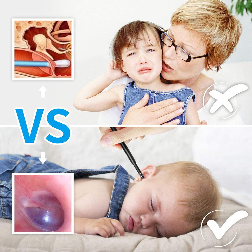 HD Ear Endoscope Otoscope LED Camera Tool Cleaning Wax Pick Cleaner Removal Kit