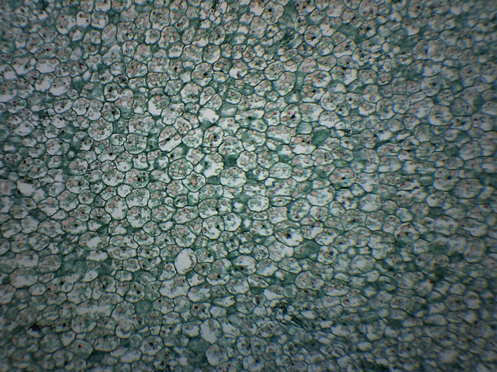 Solanum Tuber Section - Prepared Slide - 75x25mm - Eisco Labs
