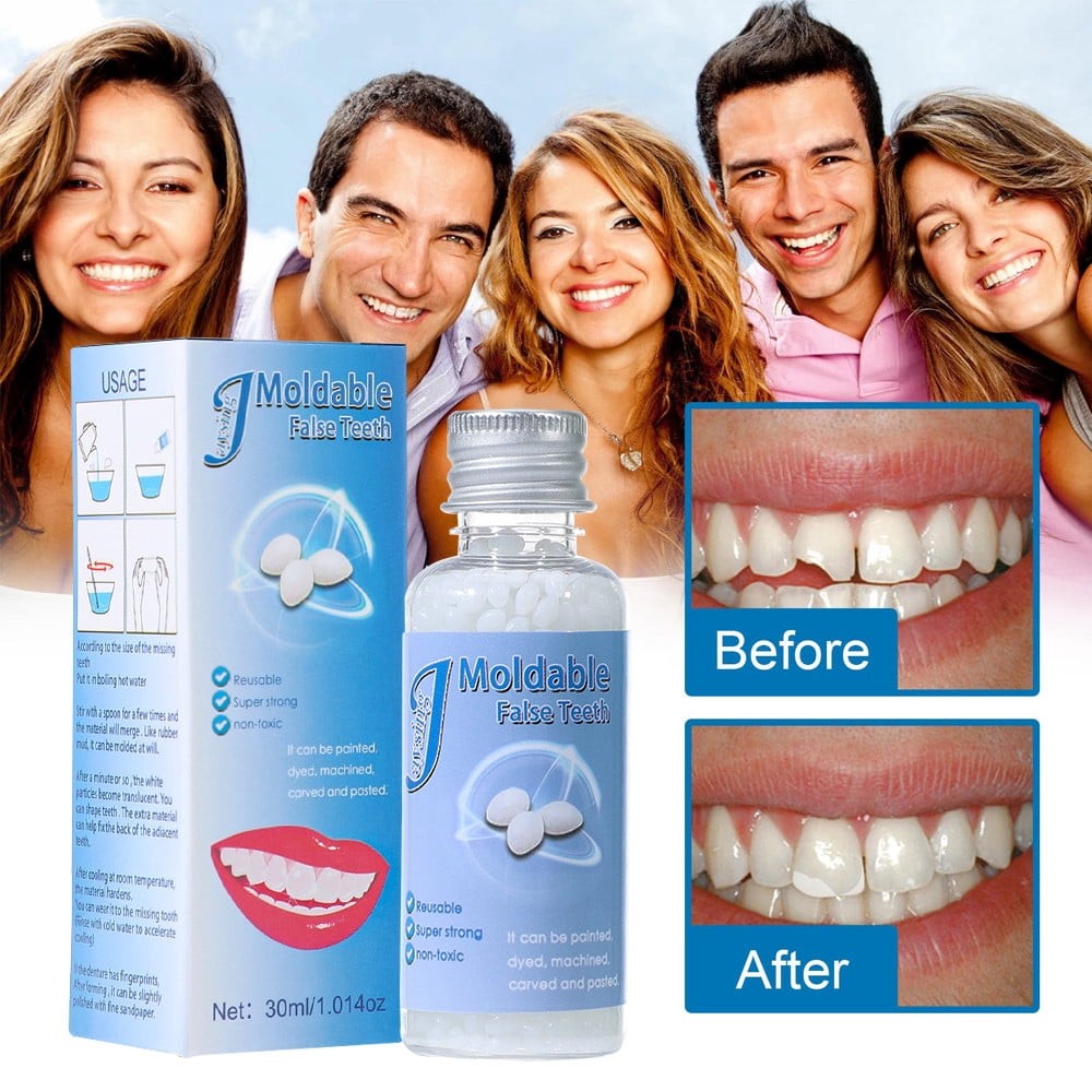 Tooth Repair Granules Temporary Fitting Beads Reusable Moldable False Teeth