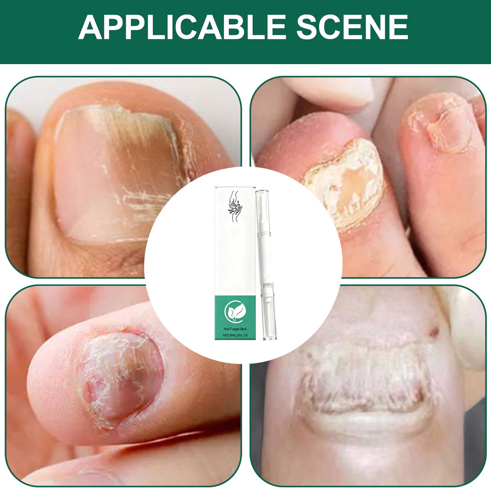 3PCS Orville Nail Fungus Pen Anti Fungus Infection Nail Care Repair Pen Toenail