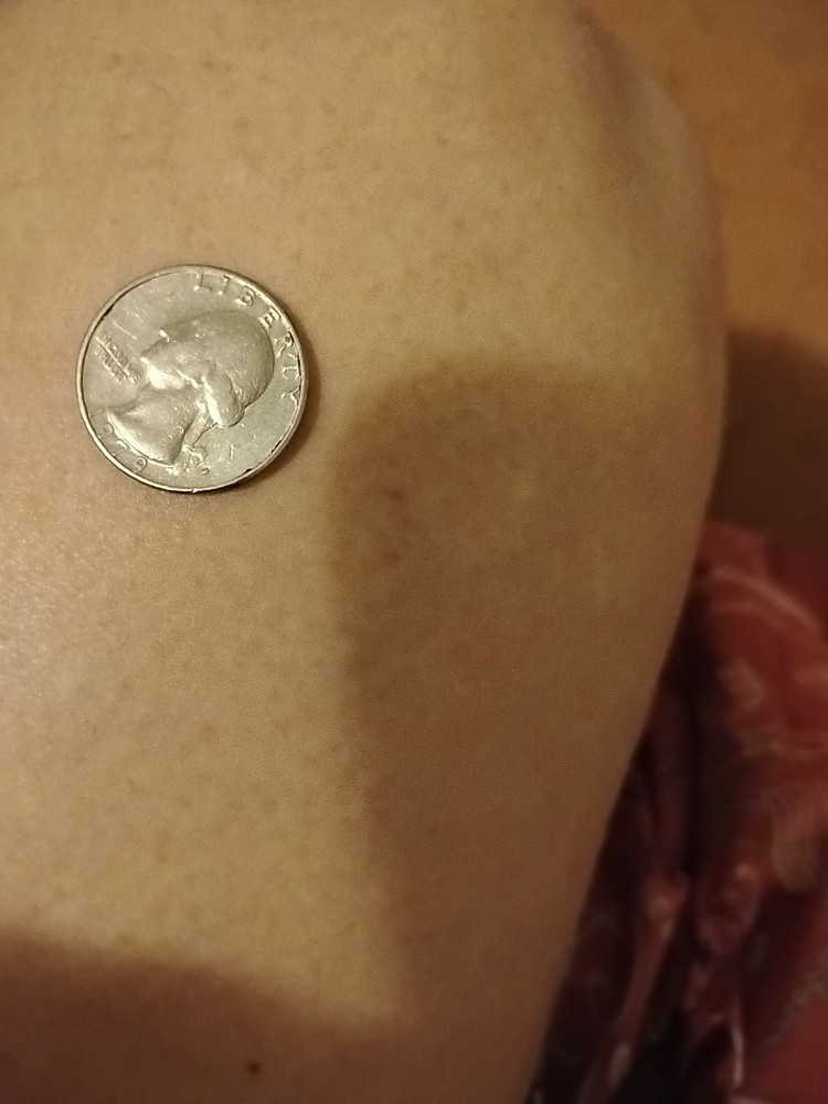 1979 Washington Quarter Filled D Mint Mark Error
