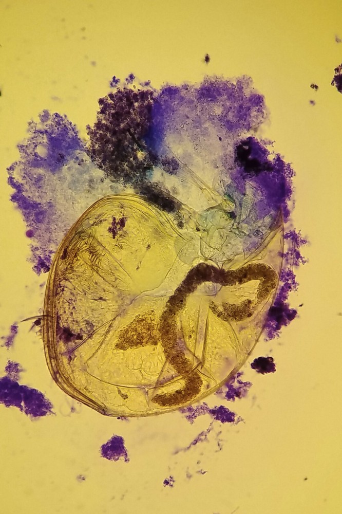 Sturdy Microscope Eyepiece Camera Adapter for Smartphone & iPhone