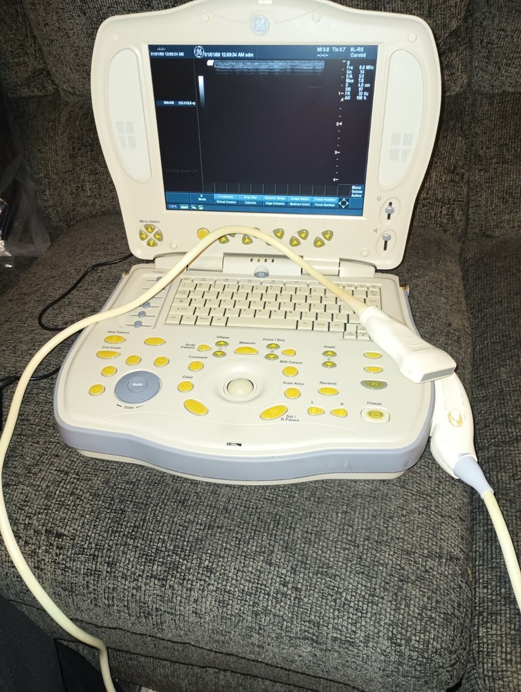 GE Logic Xp Ultrasound Machine