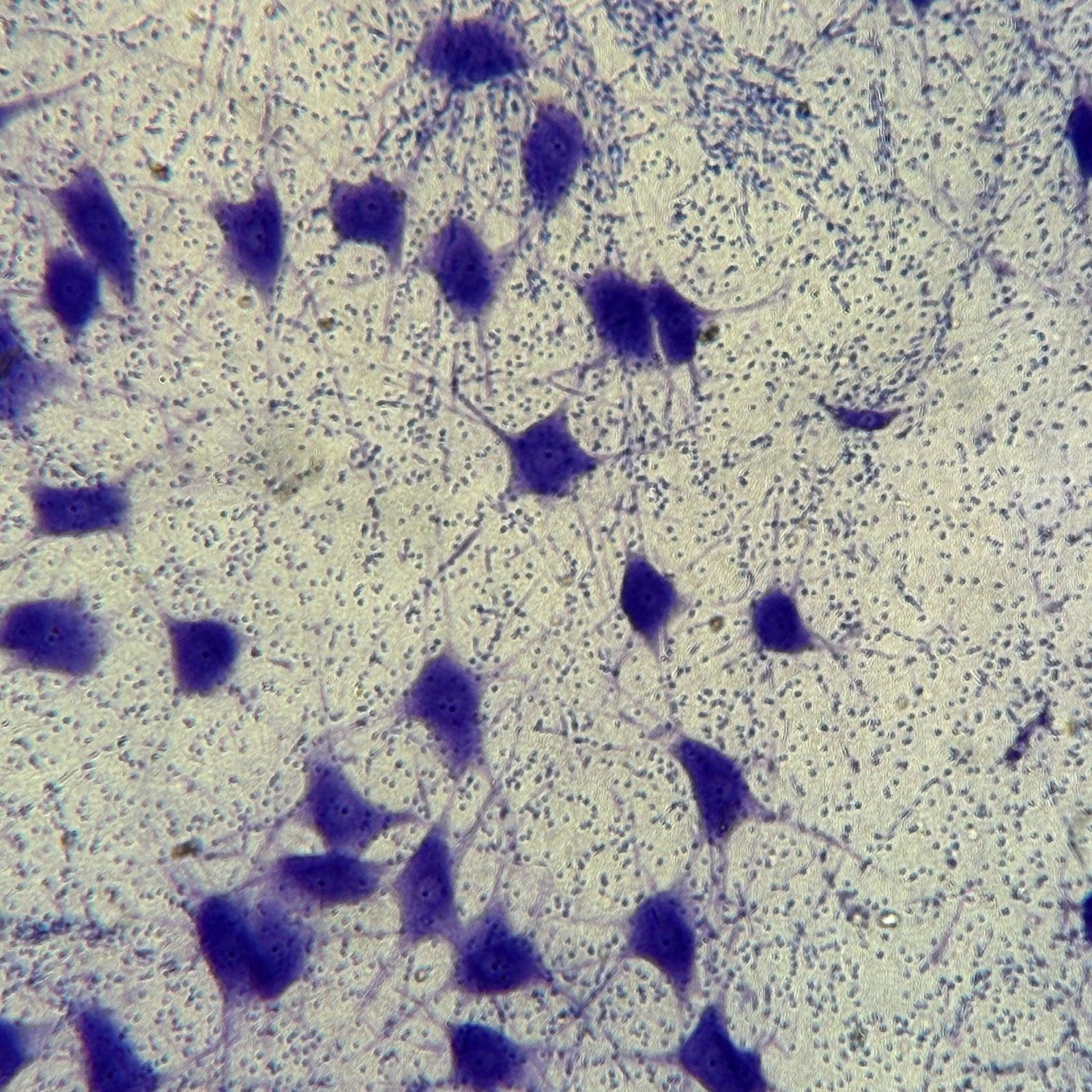 Olympus IX81F-2 Inverted Motorized Microscope w/ IX2-UCB-2 Controller