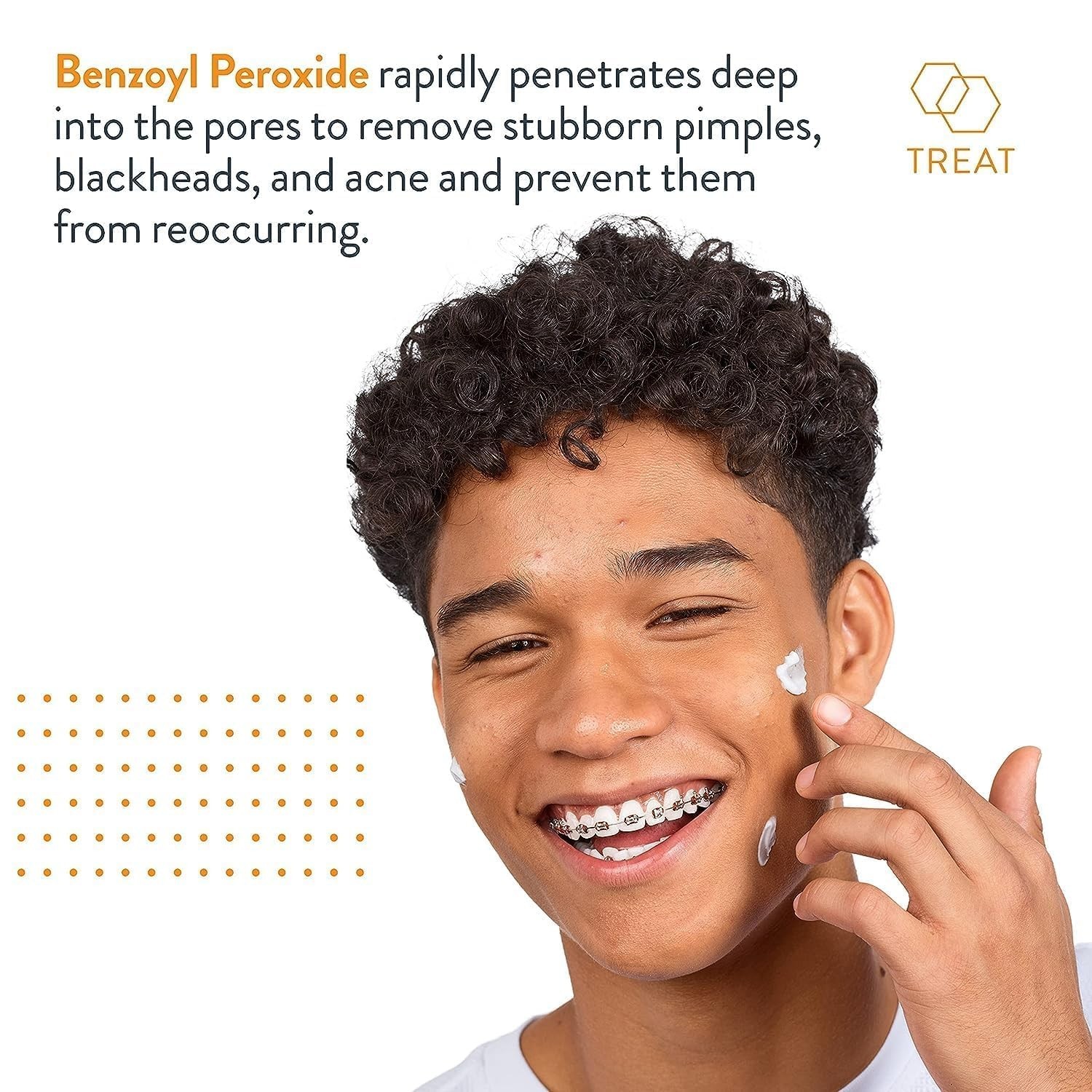 Terminator 10 Acne Spot Treatment with Benzoyl Peroxide 10% Maximum Strength 1Ct