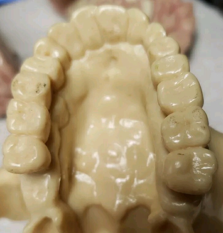 GPI Brain/ Partial Skull Model