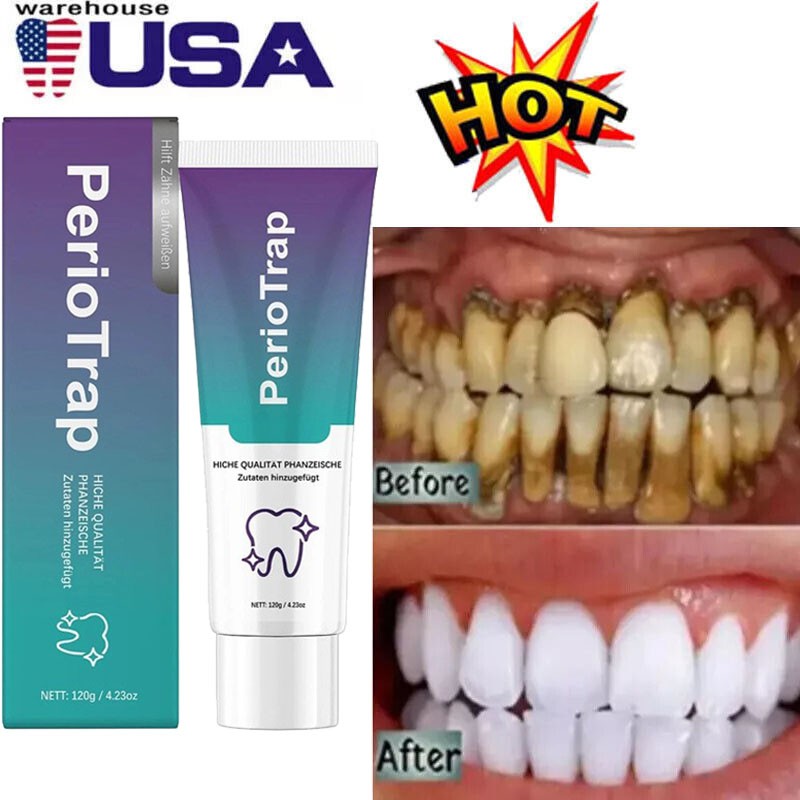 PerioTrap Mint Flavor Gum Toothpaste Cleaning Toothpaste Sensitive Teeth 120g