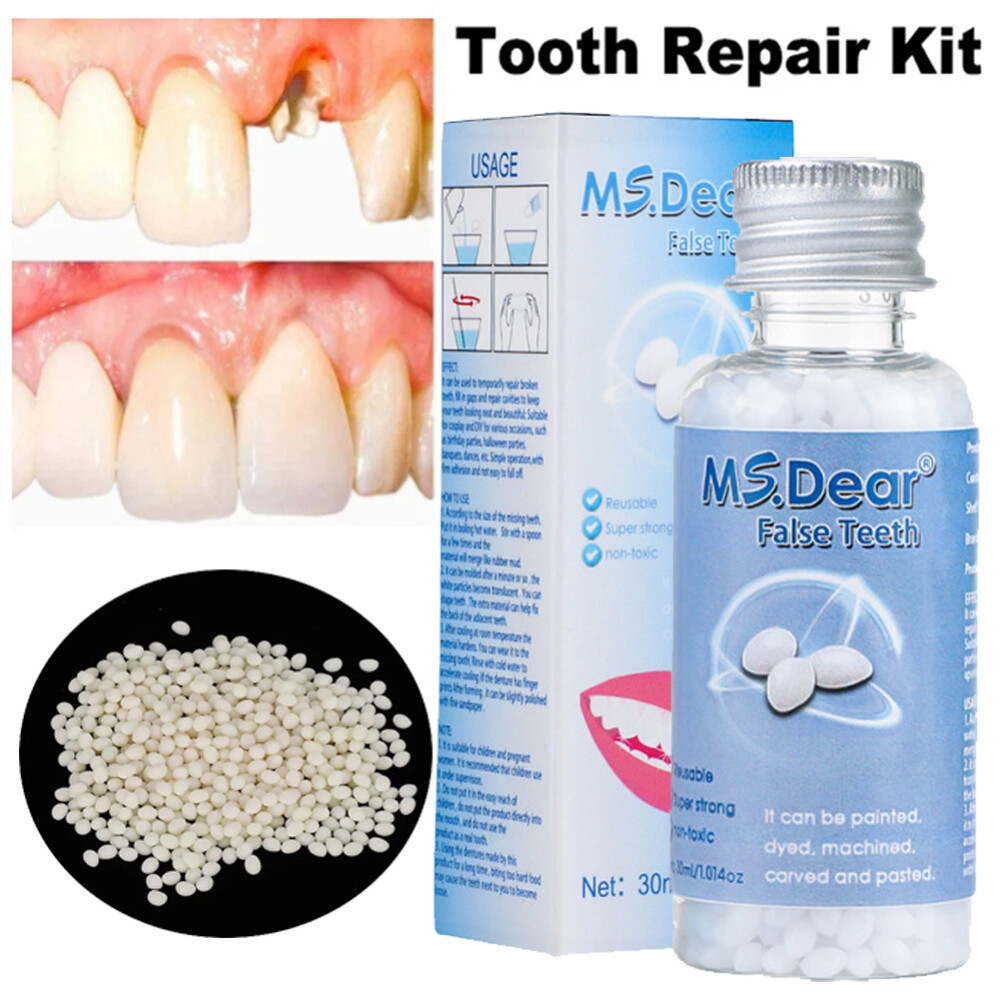 Tooth Repair Kit - Temporary Teeth Replacement Kit for Missing & Broken Teeth
