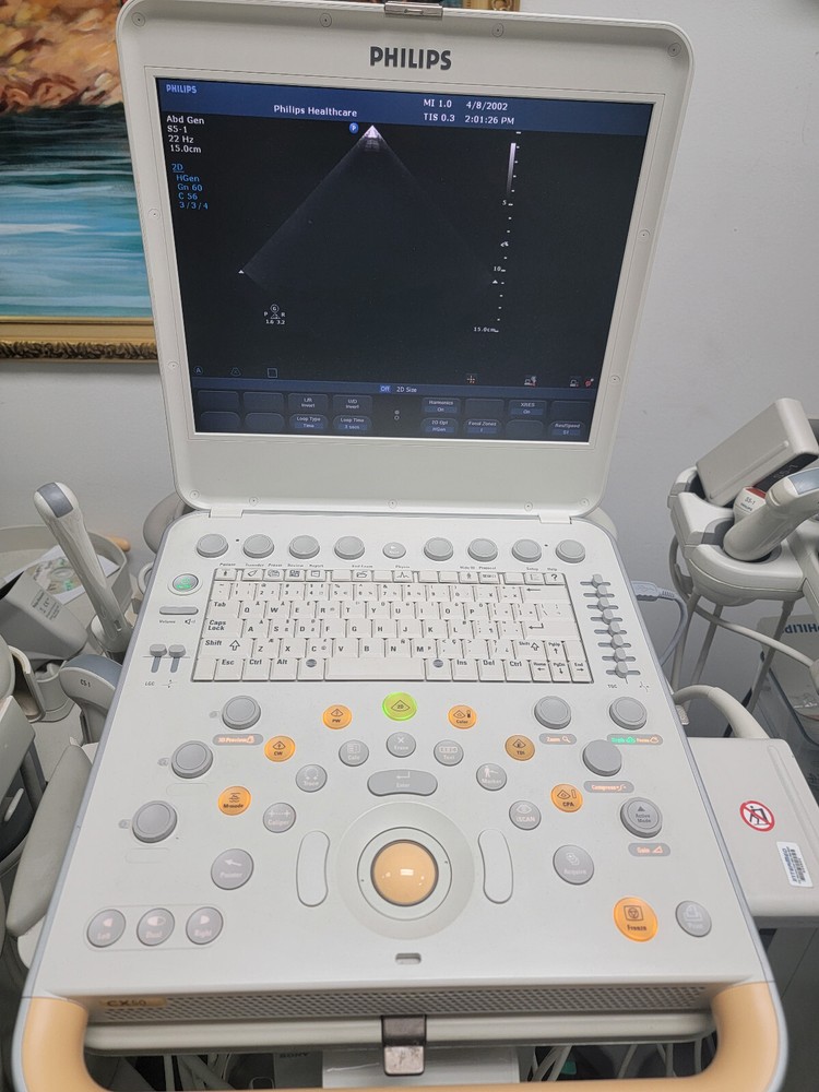 Portable Ultrasound
