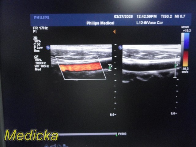 Philips L12-5 Linear Array Ultrasound Transducer *TESTED & WORKING* ~ 39679
