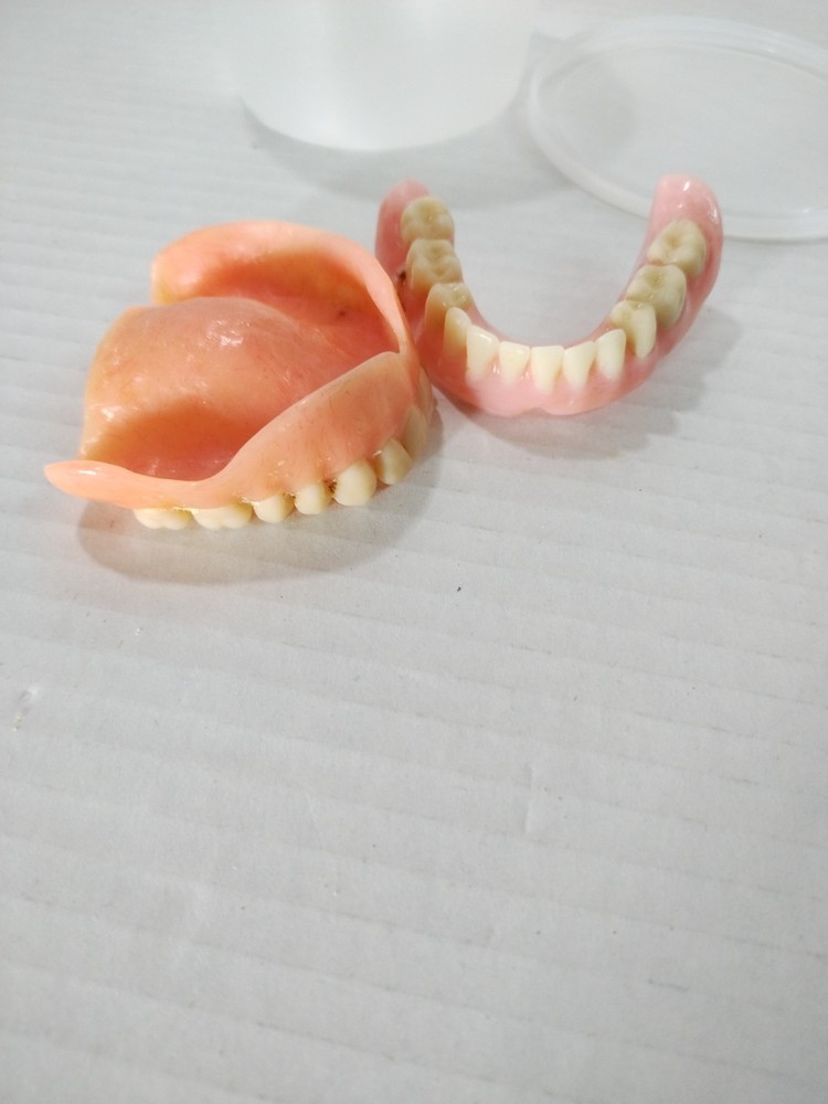 Acrylic Hard Denture Full Denture Kit – Upper & Lower | Generic Size Oddity