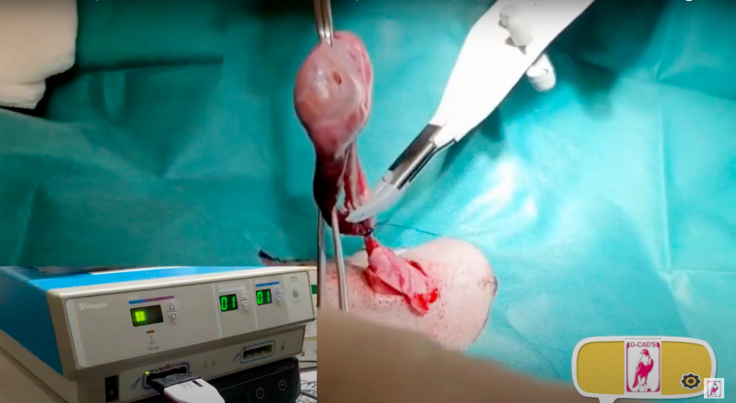 Adapter for Valleylab LigaSure 8 to Use All Covidien /Ligasure Instruments