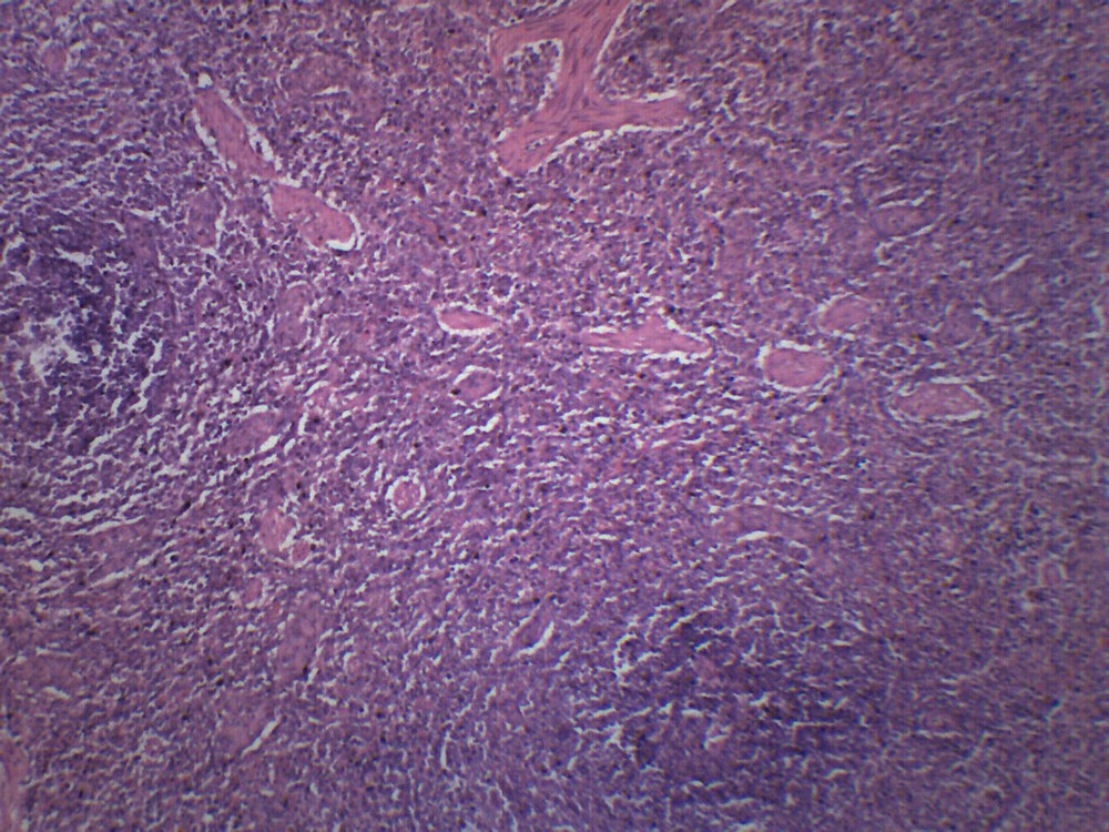 25PK Human Spleen Section - Prepared Slides - 75x25mm - Eisco Labs