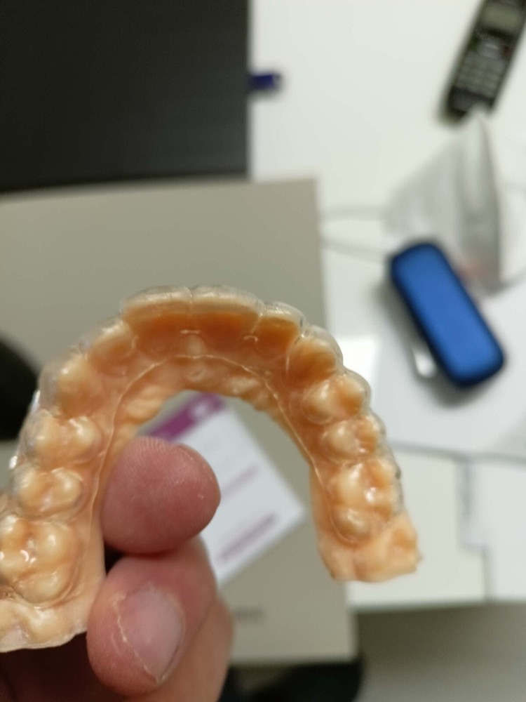 DLP SLA LCD 3d printer CLEAR ALIGNER resin