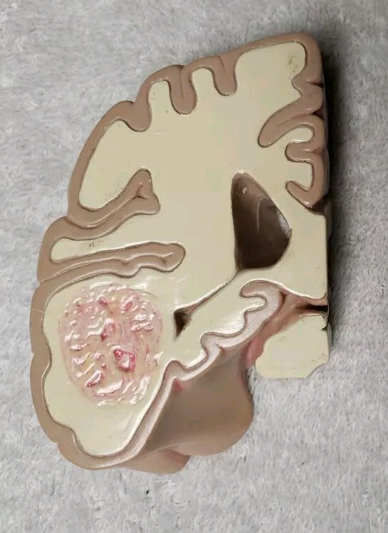 GPI Brain/ Partial Skull Model