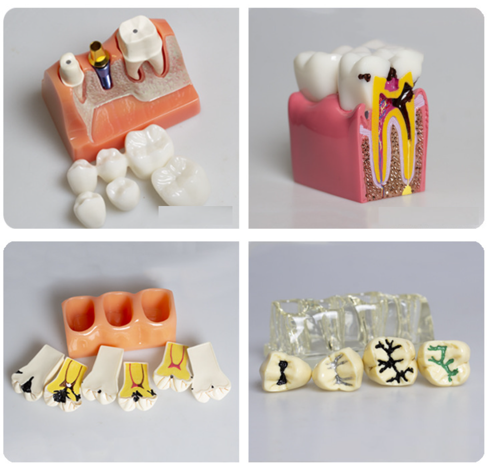 Dental Typodont Teeth Study Teach Tooth Model Implant Endo Caries Demonstration