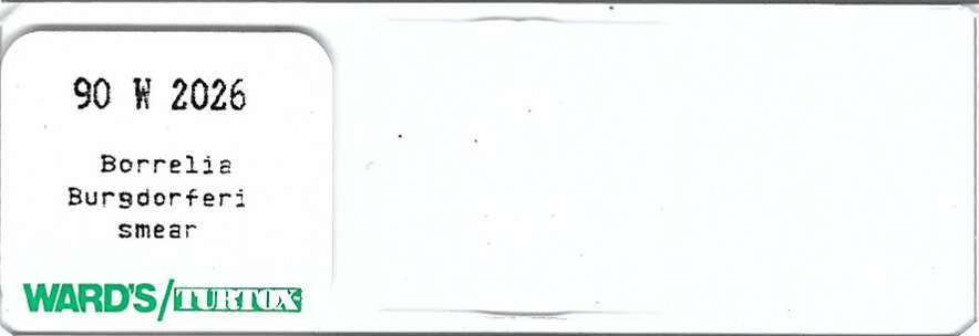 Borrelia  burgdorferi Smear Microscope Slide